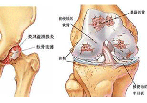 福州中德骨科医院