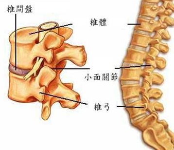 腰椎间盘突出